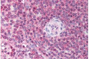 Human Spleen (formalin-fixed, paraffin-embedded) stained with USP39 antibody ABIN213731 at 2.