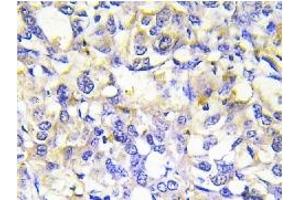 Image no. 2 for anti-Tumor Necrosis Factor Receptor Superfamily, Member 11b (TNFRSF11B) antibody (ABIN272130)