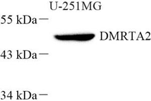 Western blot analysis of DMRTA2 (ABIN7073753) at dilution of 1: 500 (DMRTA2 anticorps)