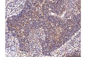 IHC analysis of ENO1 using anti-ENO1 antibody (ABIN7601902). (ENO1 anticorps  (AA 50-250))