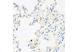 Immunohistochemistry of paraffin-embedded rat lung using NFU1 antibody at dilution of 1:200 (40x lens). (NFU1 anticorps)