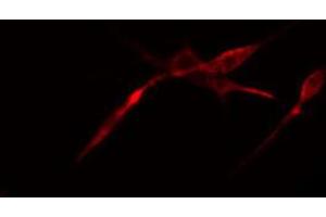 ABIN6274540 staining LOVO cells by IF/ICC.