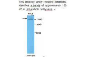 Image no. 1 for anti-Topoisomerase (DNA) II beta 180kDa (TOP2B) antibody (ABIN790819)