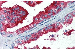Immunohistochemistry with Human Prostate lysate tissue at an antibody concentration of 5. (YAP1 anticorps  (C-Term))