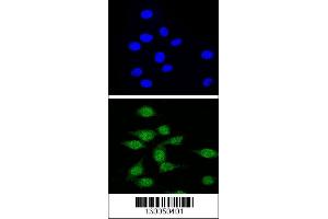 Confocal immunofluorescent analysis of AIRE Antibody with 293 cell followed by Alexa Fluor 488-conjugated goat anti-rabbit lgG (green). (AIRE anticorps  (AA 64-92))
