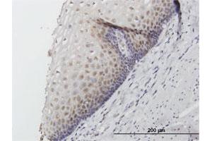 Immunoperoxidase of purified MaxPab antibody to FKBP4 on formalin-fixed paraffin-embedded human esophagus.