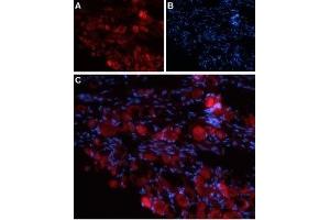 Expression of TRPV4 in rat DRG - Immunohistochemical staining of rat dorsal root ganglion (DRG) frozen sections using Anti-TRPV4 (extracellular) Antibody (ABIN7043852, ABIN7044071 and ABIN7044072).
