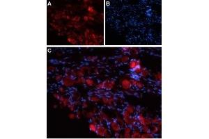 Expression of TRPV4 in rat DRG - Immunohistochemical staining of rat dorsal root ganglion (DRG) frozen sections using Anti-TRPV4 (extracellular) Antibody (ABIN7043852, ABIN7044071 and ABIN7044072). (TRPV4 anticorps  (3rd Extracellular Loop))