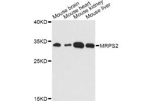 Western blot analysis of extracts of various cell lines, using MRPS2 antibody (ABIN6293851) at 1:3000 dilution.