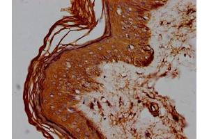 IHC image of ABIN7147160 diluted at 1:100 and staining in paraffin-embedded human skin tissue performed on a Leica BondTM system.