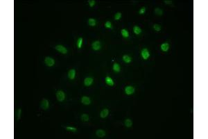 Immunofluorescence staining of A549 cells with ABIN7127721 at 1:100,counter-stained with DAPI.