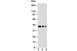 Western blot testing of GATA2 antibody and Lane 1:  recombinant human protein 10ng;  2: 5ng;  3: 2.