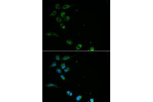 Immunofluorescence analysis of MCF-7 cells using HFE antibody. (HFE anticorps)