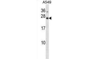 Western Blotting (WB) image for anti-Homeobox B7 (HOXB7) antibody (ABIN2998352) (HOXB7 anticorps)