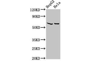 Western Blot Positive WB detected in: HepG2 whole cell lysate, Hela whole cell lysate All lanes: MT-ND5 antibody at 4. (MT-ND5 anticorps  (AA 503-581))