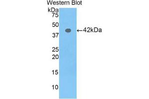 Western blot analysis of the recombinant protein. (Profilin 3 anticorps  (AA 1-132))