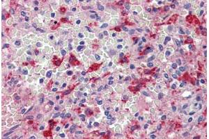 Spleen, Human: Formalin-Fixed, Paraffin-Embedded (FFPE) (HMOX1 anticorps)