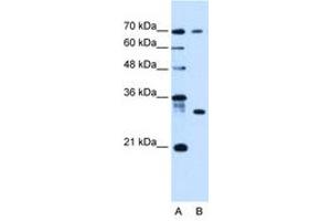 Image no. 1 for anti-ATPase, H+ Transporting, Lysosomal Accessory Protein 1-Like (ATP6AP1L) (C-Term) antibody (ABIN6736678) (ATP6AP1L anticorps  (C-Term))