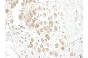 anti-BRCA2 and CDKN1A Interacting Protein (BCCIP) (AA 300-350) antibody