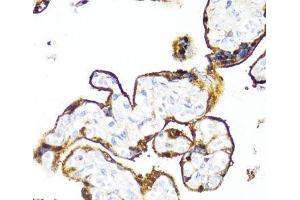 Immunohistochemistry of paraffin-embedded Human placenta using HSD17B1 Polyclonal Antibody at dilution of 1:100 (40x lens). (HSD17B1 anticorps)