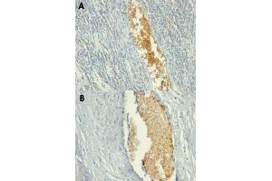 Immunohistochemical staining (Formalin-fixed paraffin-embedded sections) of human tonsil (A) and human placenta (B) with AMPD3 monoclonal antibody, clone AMPD3/901 .