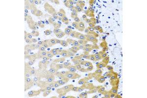 Immunohistochemistry of paraffin-embedded human liver injury using M6PR antibody. (M6PR anticorps)