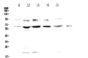 Western blot analysis of Steroid sulfatase using anti-Steroid sulfatase antibody . (STS anticorps  (AA 297-396))