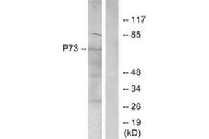 Western blot analysis of extracts from K562 cells, using p73 (Ab-99) Antibody. (Tumor Protein p73 anticorps  (AA 66-115))