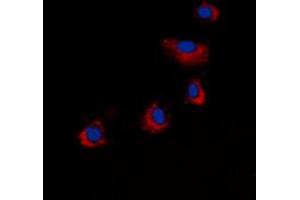 Immunofluorescent analysis of ARRDC4 staining in COLO205 cells. (ARRDC4 anticorps  (Center))