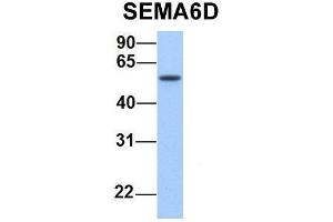 Host:  Rabbit  Target Name:  SEMA6D  Sample Type:  Human Fetal Lung  Antibody Dilution:  1. (SEMA6D anticorps  (N-Term))