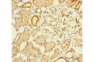 Immunohistochemistry of paraffin-embedded human kidney tissue using ABIN7145574 at dilution of 1:100 (MTHFD2 anticorps  (AA 40-250))