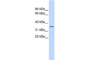 WB Suggested Anti-FCN1 Antibody Titration: 0. (FCN1 anticorps  (Middle Region))