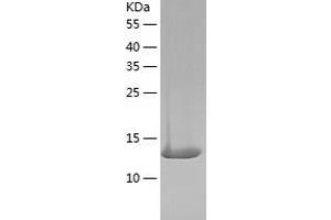 Western Blotting (WB) image for Interleukin 2 (IL2) (AA 21-155) (Active) protein (His tag) (ABIN7123568)