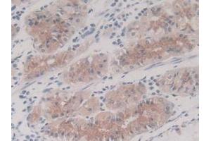 IHC-P analysis of Human Stomach Tissue, with DAB staining. (IL-8 anticorps  (AA 23-101))