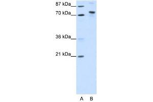 KIAA0737 antibody (20R-1215) used at 0. (TOX4 anticorps  (N-Term))