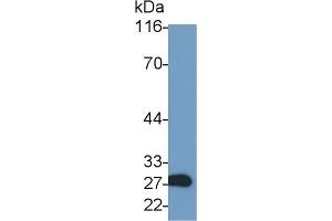 Detection of GZMA in Rat Kidney lysate using Polyclonal Antibody to Granzyme A (GZMA) (GZMA anticorps  (AA 29-260))