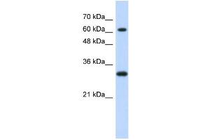 WB Suggested Anti-ERF Antibody Titration:  0. (ERF anticorps  (Middle Region))