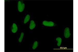 Immunofluorescence of purified MaxPab antibody to ZNF193 on HepG2 cell.