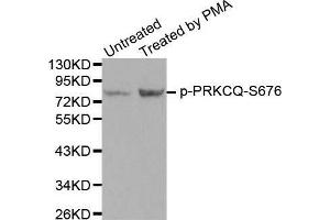 Western blot analysis of extracts from PC12 cells using Phospho-PRKCQ-S676 antibody. (PKC theta anticorps  (pSer676))