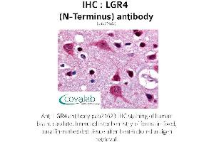 Image no. 1 for anti-Leucine-Rich Repeat Containing G Protein-Coupled Receptor 4 (LGR4) (Extracellular Domain), (N-Term) antibody (ABIN1736436)