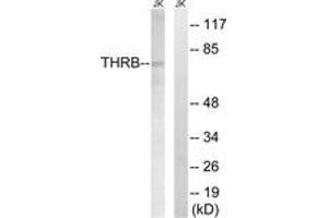 Western blot analysis of extracts from Jurkat cells, treated with etoposide 25uM 24H, using THRB (AP2,Cleaved-Arg327) Antibody. (THRB anticorps  (Cleaved-Arg327))