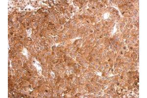 IHC-P Image Tau antibody detects MAPT protein at cytosol on D54MG xenograft by immunohistochemical analysis. (MAPT anticorps)
