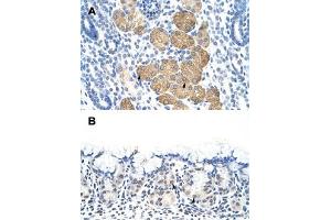 Immunohistochemical staining (Formalin-fixed paraffin-embedded sections) of human kidney (A) and human stomach (B) with DAZ4 polyclonal antibody  at 4-8 ug/mL working concentration. (DAZ4 anticorps  (N-Term))