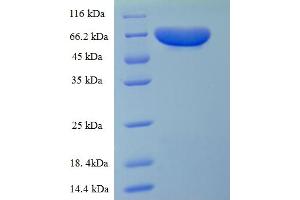 Electron-Transferring-Flavoprotein Dehydrogenase (ETFDH) (AA 34-617) protein (His tag)
