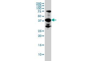 UROD monoclonal antibody (M01A), clone 1G4. (UROD anticorps  (AA 268-367))