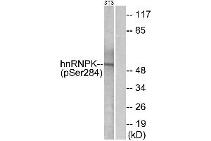 Western blot analysis of extracts from 3T3 cells, treated with EGF (200ng/ml, 30mins), using hnRNP K (Phospho-Ser284) antibody. (HNRNPK anticorps  (pSer284))