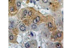 Used in DAB staining on fromalin fixed paraffin-embedded Liver tissue (C4BPB anticorps  (AA 18-252))