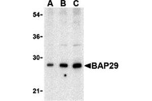 Western Blotting (WB) image for anti-B-Cell Receptor-Associated Protein 29 (BCAP29) (Middle Region) antibody (ABIN1030880) (BCAP29 anticorps  (Middle Region))