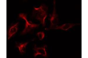 ABIN6274229 staining COLO205 cells by IF/ICC. (PRKAR1B anticorps  (Internal Region))