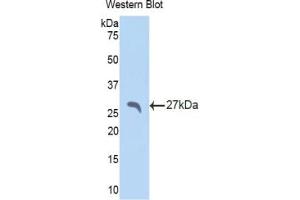 Western blot analysis of the recombinant protein. (APCS anticorps  (AA 22-222))